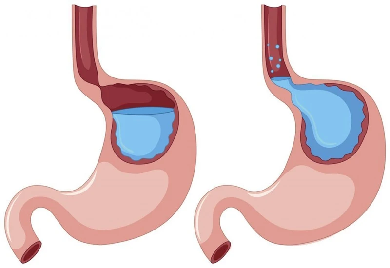 Cách chữa đắng miệng đơn giản và hiệu quả