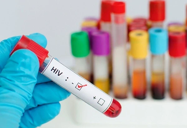 Người thứ 7 khỏi HIV: Sắp tới