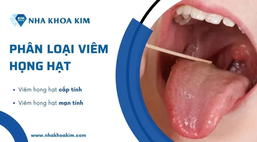 Viêm họng hạt: Nguyên nhân, Dấu hiệu và cách chữa trị