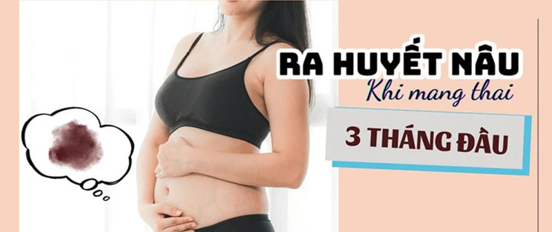 Ra huyết nâu khi mang thai 3 tháng đầu: Nguyên nhân và cách khắc phục