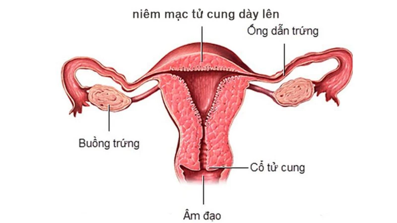 Uống Duphaston ra dịch nâu? Tìm hiểu nguyên nhân và giải đáp thắc mắc